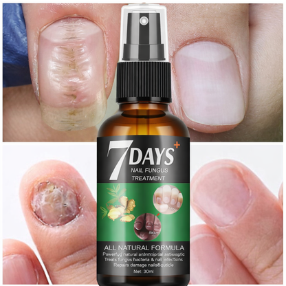 7 DAYS NAILS ENDURECEDOR DE UÑAS